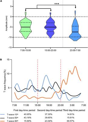 Twenty-four hour variability of inverted T-waves in patients with apical hypertrophic cardiomyopathy